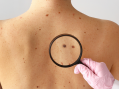 Saiba como é a importância da prevenção e os mitos associados à doença